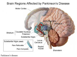 3-300x225 Living with Parkinson's Disease 